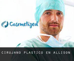 Cirujano Plástico en Allison