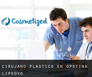Cirujano Plástico en Opstina Lipkovo Cirujano Plástico en Opstina Lipkovo
