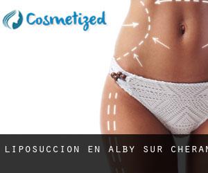 Liposucción en Alby-sur-Chéran