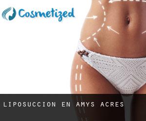 Liposucción en Amys Acres