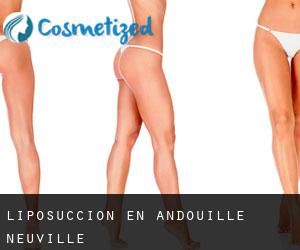 Liposucción en Andouillé-Neuville