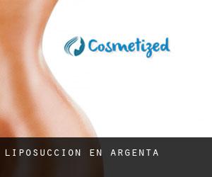 Liposucción en Argenta