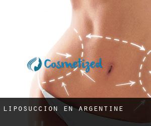 Liposucción en Argentine