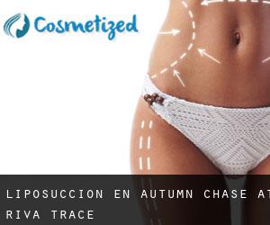Liposucción en Autumn Chase at Riva Trace