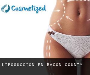 Liposucción en Bacon County