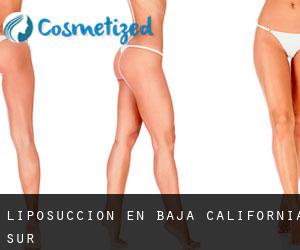 Liposucción en Baja California Sur