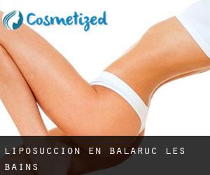 Liposucción en Balaruc-les-Bains