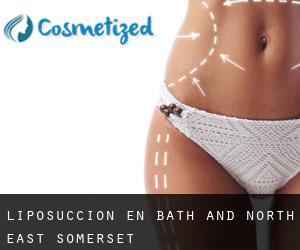 Liposucción en Bath and North East Somerset