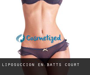 Liposucción en Batts Court