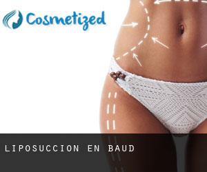 Liposucción en Baud