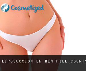 Liposucción en Ben Hill County