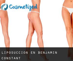 Liposucción en Benjamin Constant