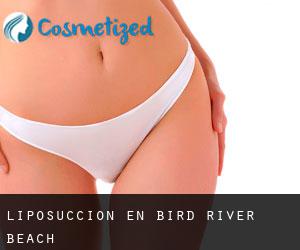 Liposucción en Bird River Beach
