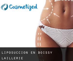 Liposucción en Boissy-l'Aillerie
