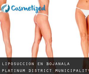 Liposucción en Bojanala Platinum District Municipality