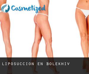 Liposucción en Bolekhiv