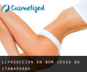 Liposucción en Bom Jesus do Itabapoana