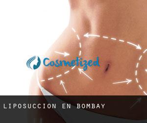 Liposucción en Bombay