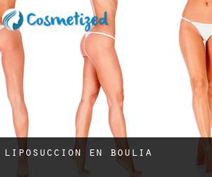 Liposucción en Boulia