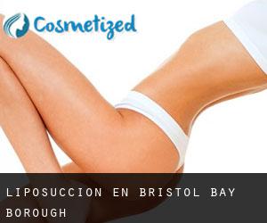 Liposucción en Bristol Bay Borough