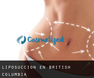 Liposucción en British Columbia