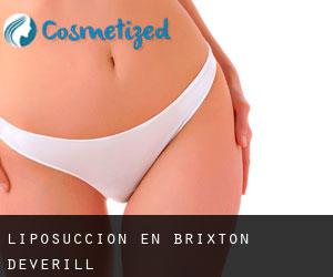 Liposucción en Brixton Deverill