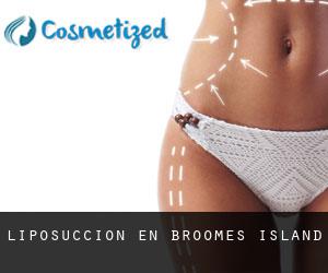 Liposucción en Broomes Island