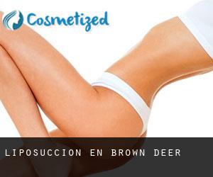 Liposucción en Brown Deer