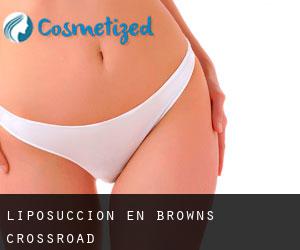 Liposucción en Browns Crossroad