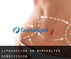 Liposucción en Burkhalter Subdivision