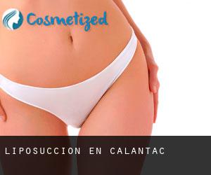 Liposucción en Calantac