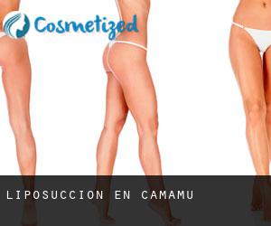 Liposucción en Camamu