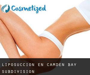 Liposucción en Camden Bay Subdivision