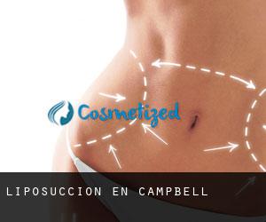 Liposucción en Campbell