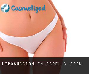 Liposucción en Capel-y-ffin