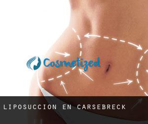 Liposucción en Carsebreck