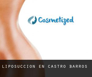 Liposucción en Castro Barros