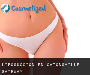 Liposucción en Catonsville Gateway