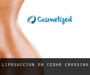 Liposucción en Cedar Crossing