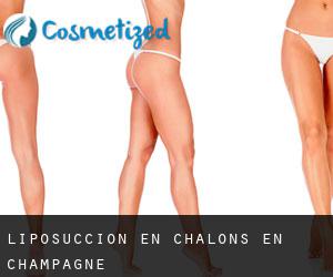 Liposucción en Châlons-en-Champagne