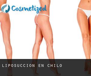 Liposucción en Chilo