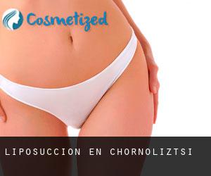 Liposucción en Chornoliztsi