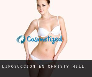Liposucción en Christy Hill