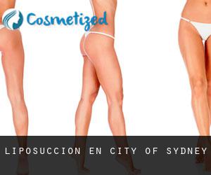 Liposucción en City of Sydney