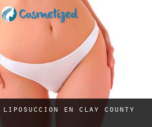 Liposucción en Clay County