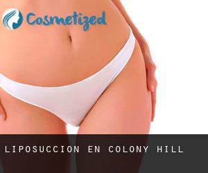 Liposucción en Colony Hill