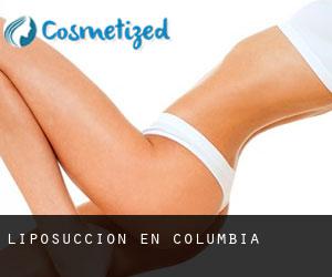 Liposucción en Columbia