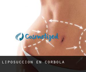 Liposucción en Corbola