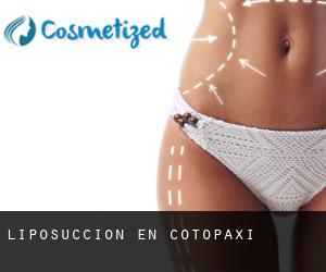 Liposucción en Cotopaxi