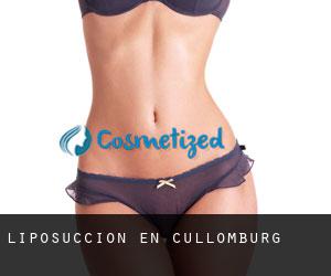 Liposucción en Cullomburg